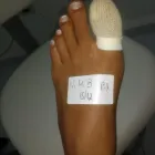 Imagem 4 da empresa CHEZ LE PODOLOGUE vgabriela podologia em Rio De Janeiro RJ