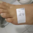 Imagem 6 da empresa CHEZ LE PODOLOGUE vgabriela podologia em Rio De Janeiro RJ