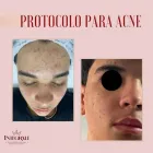 Imagem 4 da empresa CLINICA INTEGRALI SAÚDE E ESTÉTICA Cabeleireiros E Institutos De Beleza em Taguatinga DF