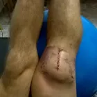 Imagem 4 da empresa FISIOTERAPIA(CONSULTORIO E DOMICILIAR) - ARMINDO PERDIGÃO Fisioterapia em Curitiba PR