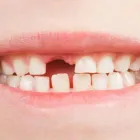 Imagem 3 da empresa ODONTOPEDIATRIA Cirurgiões-Dentistas - Periodontia em São Paulo SP