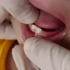 Imagem 4 da empresa ODONTOPEDIATRIA Cirurgiões-Dentistas - Periodontia em São Paulo SP