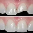 Imagem 8 da empresa ODONTOPEDIATRIA Cirurgiões-Dentistas - Periodontia em São Paulo SP