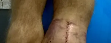 Imagem 4 da empresa FISIOTERAPIA(CONSULTORIO E DOMICILIAR) - ARMINDO PERDIGÃO Fisioterapia em Curitiba PR