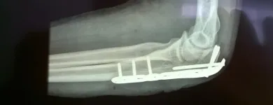 Imagem 3 da empresa FISIOTERAPIA(CONSULTORIO E DOMICILIAR) - ARMINDO PERDIGÃO Fisioterapia em Curitiba PR