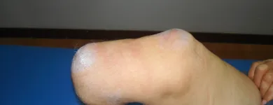 Imagem 1 da empresa FISIOTERAPIA(CONSULTORIO E DOMICILIAR) - ARMINDO PERDIGÃO Fisioterapia em Curitiba PR