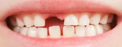 Imagem 3 da empresa ODONTOPEDIATRIA Cirurgiões-Dentistas - Periodontia em São Paulo SP