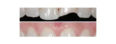 Imagem 8 da empresa ODONTOPEDIATRIA Cirurgiões-Dentistas - Periodontia em São Paulo SP